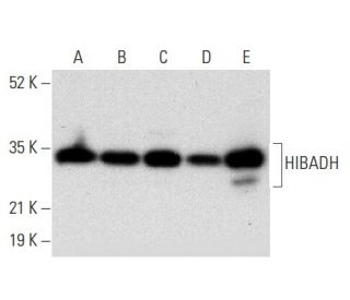 HIBADH Antibody (D-11) - Western Blotting - Image 303747 