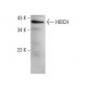 HIBCH Antibody (E-11) - Western Blotting - Image 384771