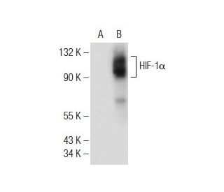 HIF1a Antibody (H1α 67) - Western Blotting - Image 146311Each CRISPR/Cas9 Knockout (KO) Plasmid product consists of a pool of 3 plasmids designed to ensure identification and cleavage of a specific gene for maximum knockout efficiency. Each plasmid encodes a unique 20 nt sequence derived from the GeCKO (v2) library.