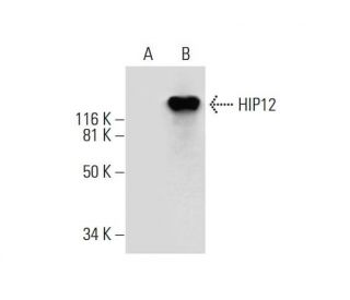 HIP12 Antibody (D-6) - Western Blotting - Image 289897