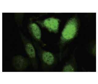 HIPK1 Antibody (SR-5) - Immunofluorescence - Image 35547 