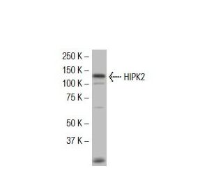 HIPK2 Antibody (F-189) - Western Blotting - Image 33759Each CRISPR/Cas9 Knockout (KO) Plasmid product consists of a pool of 3 plasmids designed to ensure identification and cleavage of a specific gene for maximum knockout efficiency. Each plasmid encodes a unique 20 nt sequence derived from the GeCKO (v2) library.