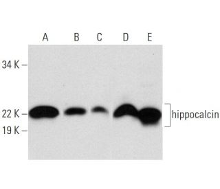 hippocalcin Antibody (G-8) - Western Blotting - Image 292109Each CRISPR/Cas9 Knockout (KO) Plasmid product consists of a pool of 3 plasmids designed to ensure identification and cleavage of a specific gene for maximum knockout efficiency. Each plasmid encodes a unique 20 nt sequence derived from the GeCKO (v2) library.