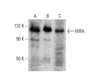 HIRA Antibody (374C6a) - Western Blotting - Image 384294 
