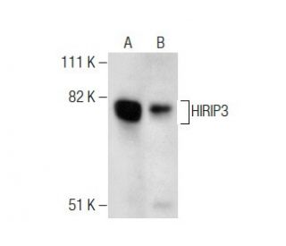 HIRIP3 Antibody (2415C2a) - Western Blotting - Image 283392 