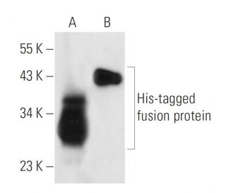 His-Tag Antibody (AD1.1.10) - Western Blotting - Image 14079