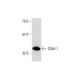 SIAH-1 (N-15): sc-5505. Western blot analysis of SIAH-1 expression in HISM whole cell lysate.
