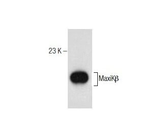 MaxiKβ Antibody (A-5) - Western Blotting - Image 260767 