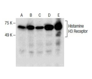 Histamine H3 Receptor Antibody (D-5) - Western Blotting - Image 286739SAM Transcription Activation: SAM system utilizing dCas9-VP64, MS2-P65-HSF1, and sgRNA for precise gene transcription activation.