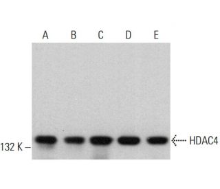 Histone Deacetylase 4 (HDAC4) Antibody (D-1) - Western Blotting - Image 379809