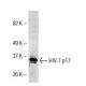 HIV-1 p17 Antibody (17-1) - Western Blotting - Image 38346
