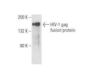 HIV-1 p24 Antibody (24-4) - Western Blotting - Image 57821