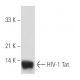 HIV-1 Tat Antibody (02-012) - Western Blotting - Image 19129