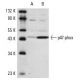 HL-60 + DMSO Cell Lysate: sc-24703. Western blot analysis of...