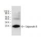HL-60 + DMSO Cell Lysate: sc-24703. Western blot analysis of... 