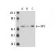 RIP2 (Nick-1): sc-56227. Western blot analysis of RIP2 expression in...
