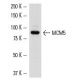 HL-60 nuclear extract: sc-2147. Western blot analysis of MCM5 expression... 