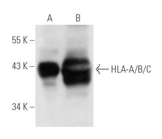 HLA-A/B/C Antibody (LY5.1) - Western Blotting - Image 14021 