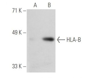 HLA-A/B/C Antibody (LY5.1) - Western Blotting - Image 21707