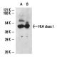 HLA class I Antibody (MEM-147) - Western Blotting - Image 12466
