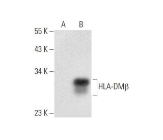 HLA-DMβ Antibody (E-8) - Western Blotting - Image 296272Each CRISPR/Cas9 Knockout (KO) Plasmid product consists of a pool of 3 plasmids designed to ensure identification and cleavage of a specific gene for maximum knockout efficiency. Each plasmid encodes a unique 20 nt sequence derived from the GeCKO (v2) library.