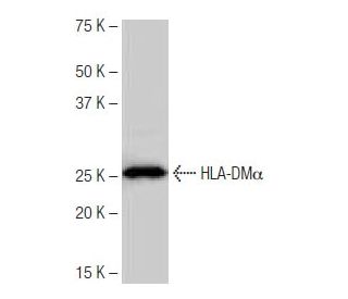HLA-DM&alpha; Antibody (NB-B33) - Western Blotting - Image 64960 