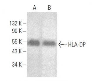 HLA-DP Antibody (BRAFB6) - Western Blotting - Image 354490 