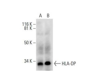 HLA-DP Antibody (G-9) - Western Blotting - Image 289529 