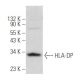 HLA-DP Antibody (G-9) - Western Blotting - Image 357705