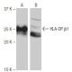 HLA-DP β1 Antibody (7-RE35) - Western Blotting - Image 64962 
