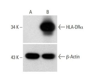 HLA-DR alpha CRISPR Activation Plasmid (h): sc-401010-ACT. Western blot analysis of... 