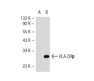 HLA-DR Antibody (2.06) - Western Blotting - Image 33035 