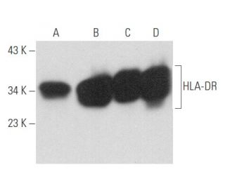 HLA-DR Antibody (6A96) - Western Blotting - Image 357682 