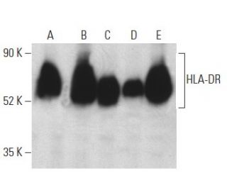 HLA-DR Antibody (Bra20) - Western Blotting - Image 399157 