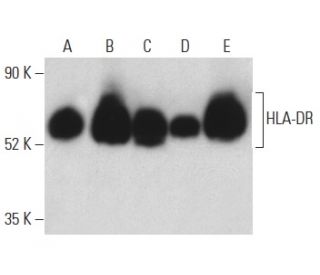 HLA-DR Antibody (Bra30) - Western Blotting - Image 399151 