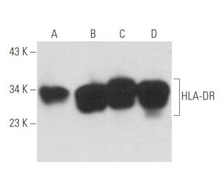 HLA-DR Antibody (SPM289) - Western Blotting - Image 357681 