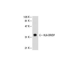 HLA-DR/DP Antibody (MEM-136) - Western Blotting - Image 31372 