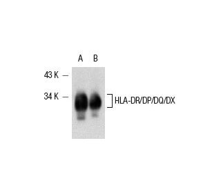 HLA-DR/DP/DQ/DX Antibody (CR3/43) - Western Blotting - Image 13454 