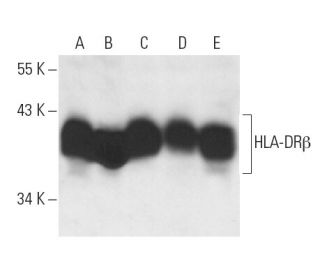 HLA-DR&beta; Antibody (DA2) - Western Blotting - Image 12973 
