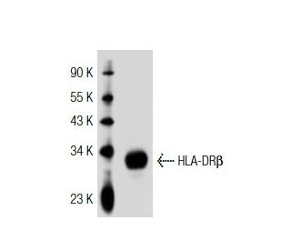 HLA-DR&beta; Antibody (HB10A) - Western Blotting - Image 33015 