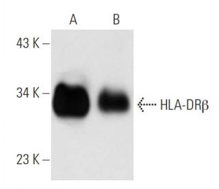 HLA-DR&beta; Antibody (TAL 14.1) - Western Blotting - Image 14762 