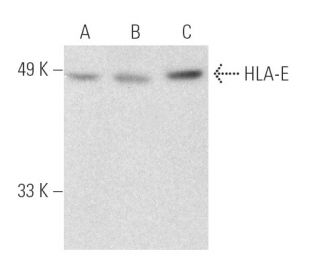 HLA-E Antibody (4D12) - Western Blotting - Image 390963