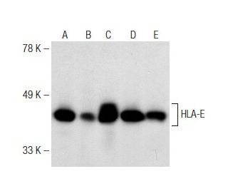 HLA-E Antibody (MEM-E/02) - Western Blotting - Image 149069 