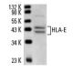 HLA-E Antibody (MEM-E/06) - Western Blotting - Image 14017 
