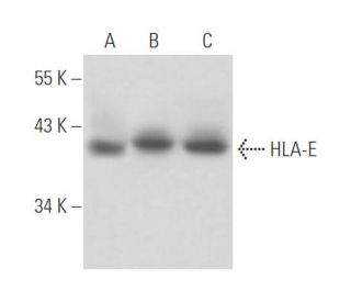 HLA-E Antibody (MEM-E/06) - Western Blotting - Image 16137 