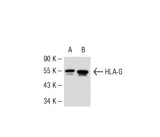 HLA-G Antibody (MEM-G/2) - Western Blotting - Image 52828 