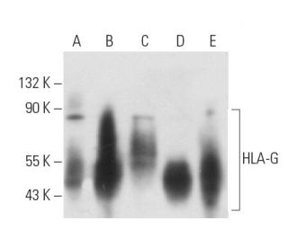 HLA-G Antibody (MEM-G/9) - Western Blotting - Image 12749