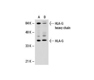 HLA-G Antibody (MEM-G/1) - Western Blotting - Image 18517