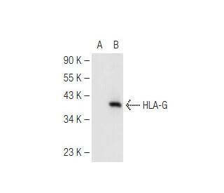 HLA-G (MEM-G/1): sc-51674. Western blot analysis of HLA-G expression in non-transfected: sc-117752 (A) and human HLA-G tra 