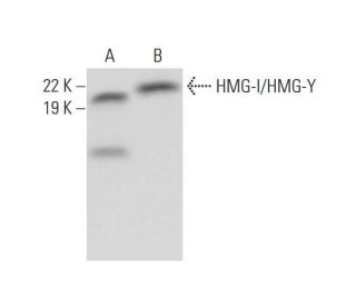HMG-I/HMG-Y Antibody (D-12) - Western Blotting - Image 292975Each CRISPR/Cas9 Knockout (KO) Plasmid product consists of a pool of 3 plasmids designed to ensure identification and cleavage of a specific gene for maximum knockout efficiency. Each plasmid encodes a unique 20 nt sequence derived from the GeCKO (v2) library.